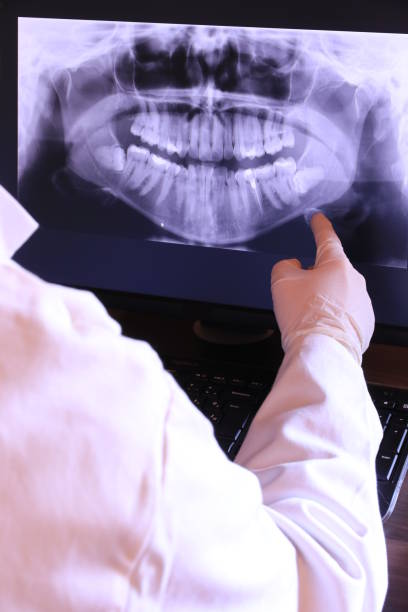 Dentist for Dental Trauma in GA